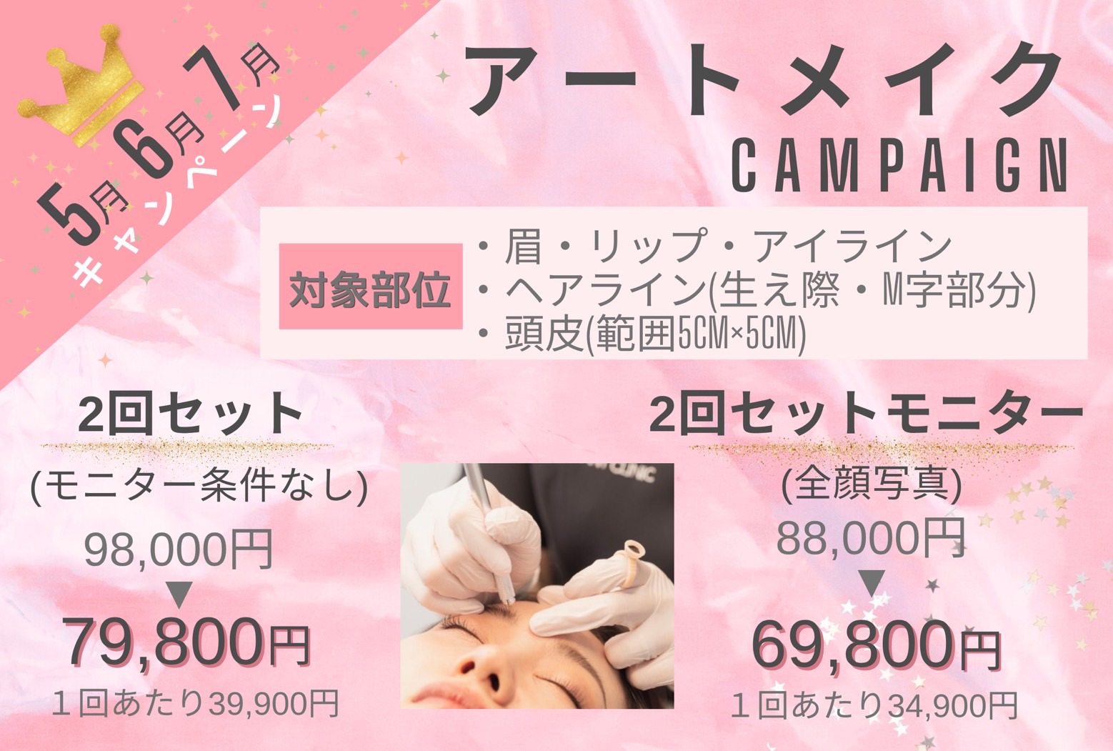 アートメイクキャンペーン